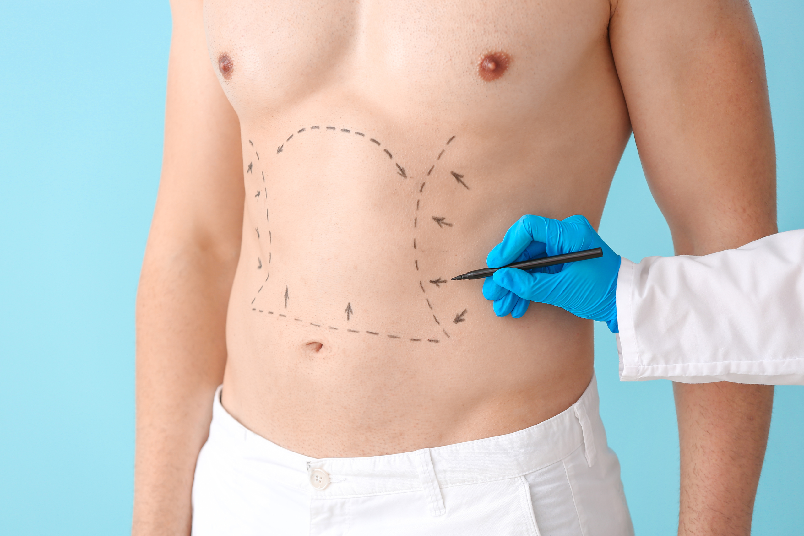 Body Surgery