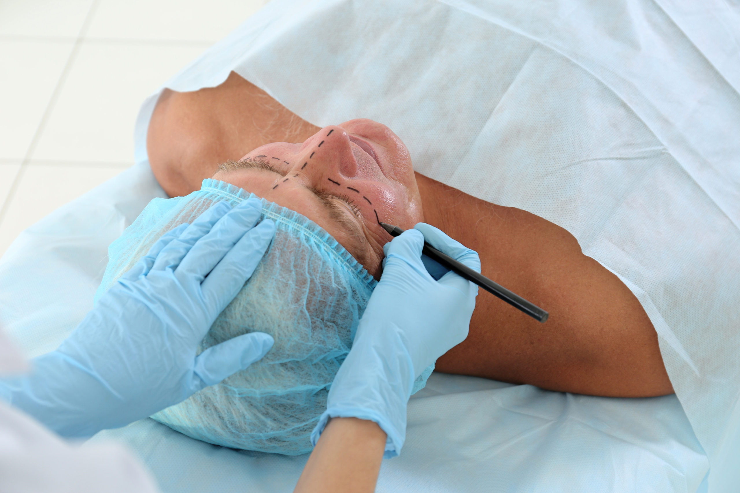 Facial Surgery 